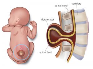 neurosurgeon in nashik