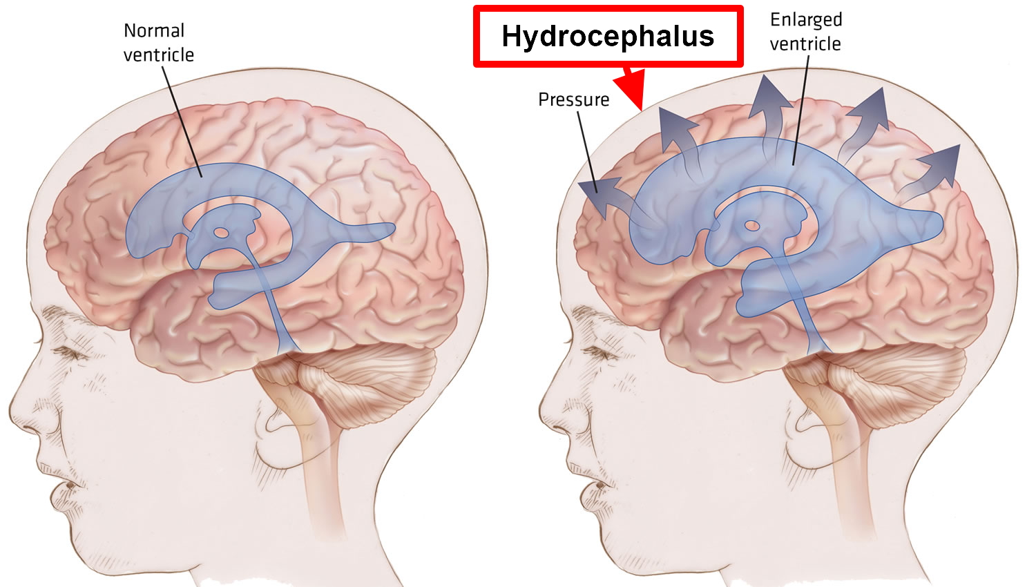 neurosurgeon in nashik