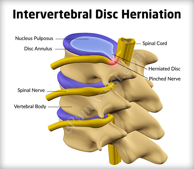 vertebral column discs