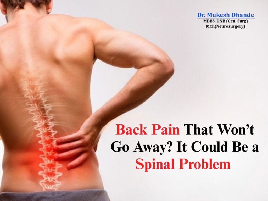 Back Pain That Won’t Go Away? It Could Be a Spinal Problem